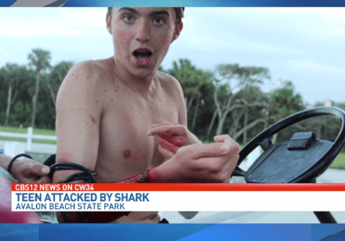 SharkBanz investigates local teen’s rare attack wearing shark repelling band